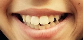 Picture of Ruth Righi teeth and smile
