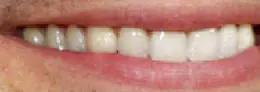Ryan Seacrest's teeth and smile