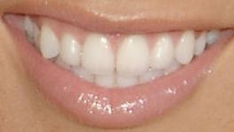 Picture of Sabrina Bryan teeth and smile