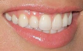 Picture of Sabrina Bryan teeth and smile