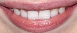 Picture of Sabrina Carpenter teeth and smile
