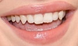 Picture of Sabrina Carpenter teeth and smile