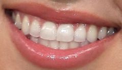 Sadie Robertson teeth