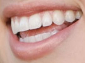 Sadie Robertson teeth
