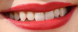 Picture of Sadie Sink teeth and smile