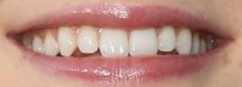 Picture of Sadie Sink teeth and smile