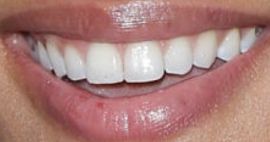Picture of Sal Stowers teeth and smile