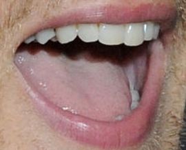Picture of Sam Heughan teeth and smile