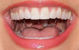 Picture of Samantha Harris teeth and smile