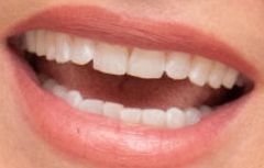 Sandra Bullock teeth