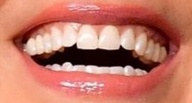 Image of Sandra Bullock teeth