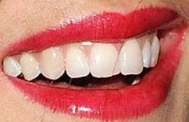 Picture of Sarah Butler teeth and smile