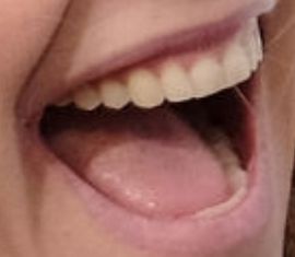 Picture of Sarah Chalke teeth and smile