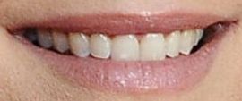 Picture of Sarah Chalke teeth and smile