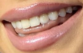 Picture of Sarah Hyland teeth and smile