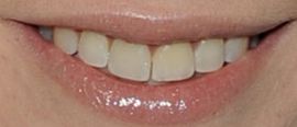 Picture of Sarah Jones actress teeth and smile