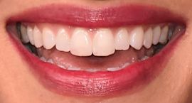 Picture of Sarah Shahi teeth and smile