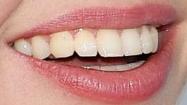 Picture of Sasha Luss teeth and smile