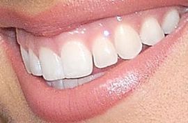 Picture of Savannah Chrisley teeth and smile