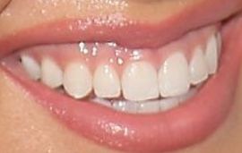 Picture of Savannah Chrisley teeth and smile