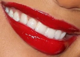 Picture of Saweetie teeth and smile