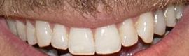 Picture of Scott Clifton teeth and smile