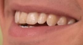 Picture of Sean Giambrone teeth and smile