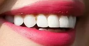 Picture Selena Gomez's teeth and smile