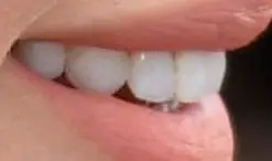 Picture Selena Gomez's teeth and smile