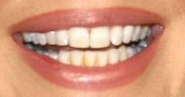 Picture of Shanna Moakler teeth and smile