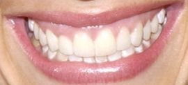 Picture of Shannon Elizabeth teeth and smile