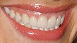 Picture of Shannon Elizabeth teeth and smile