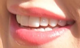 Picture of Sharna Burgess teeth and smile