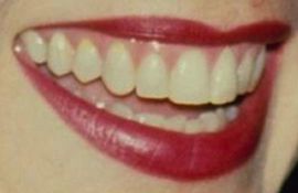 Picture of Sharon Stone teeth and smile