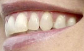Picture of Sharon Stone teeth and smile