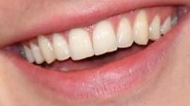 Shawn Mendes teeth and smile