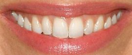 Picture of Sienna Miller teeth and smile