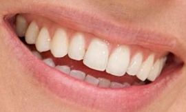 Picture of Sienna Miller teeth and smile