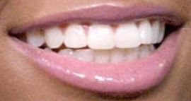 Picture of Skai Jackson teeth and smile