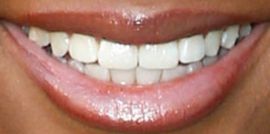 Picture of Skai Jackson teeth and smile