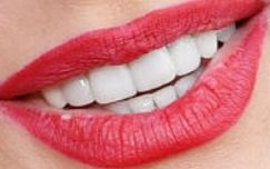 Picture of Sofia Vergara teeth and smile