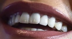 Picture of Sofia Vergara teeth and smile