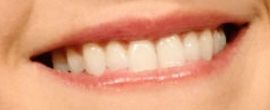 Picture of Sophie Skelton teeth and smile