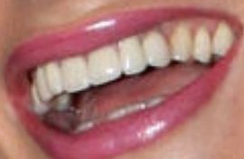 Picture of Sophie Turner teeth and smile