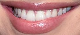 Picture of Stassi Schroeder teeth and smile