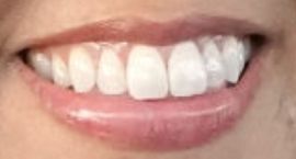 Picture of Stephanie Beatriz teeth and smile
