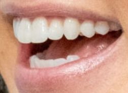 Picture of Stephanie McMahon's teeth and smile