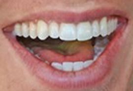 Picture of Stephen Sharer teeth and smile