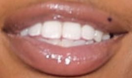 Picture of SZA teeth and smile