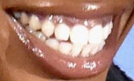 Picture of SZA teeth and smile